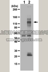 merck millipore,默克密理博,ABF131,Anti-phospho TIE2/TEK Antibody (Tyr992)
