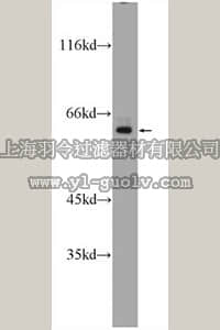 merck millipore,默克密理博,ABF236,Anti-SP110 Antibody merck millipore,默克密理博,ABF236,Anti-SP110 Antibody