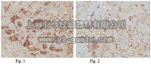 merck millipore,默克密理博,ABN100,Anti-Vesicular Acetylcholine Transporter (VAChT) Antibody