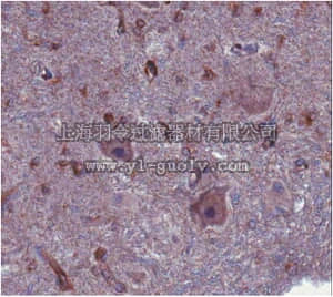 merck millipore,默克密理博,ABN103,Anti-Tau-tubulin kinase 2 (TTBK2) Antibody