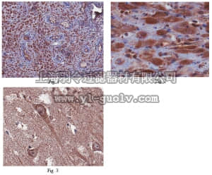 merck millipore,默克密理博,ABN164,Anti-IL22RA2 Antibody
