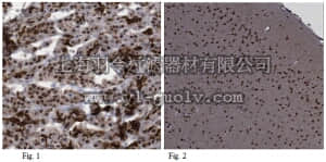 merck millipore,默克密理博,ABN174,Anti-MNX1 (HB9) Antibody