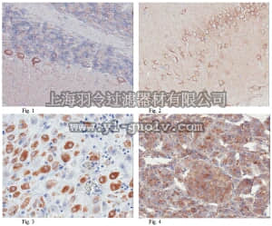 merck millipore,默克密理博,ABN180,Anti-TFG Antibody