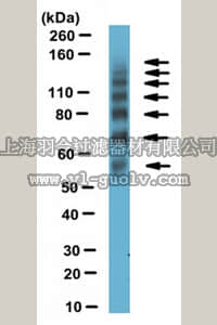 merck millipore,默克密理博,ABN190,Anti-CEA cell adhesion molecule 16 (Ceacam16) Antibody