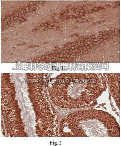 merck millipore,默克密理博,ABN193,Anti-Dickkopf-like protein 1 (DKKL1) Antibody