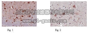 merck millipore,默克密理博,ABN194,Anti-EVI-5 Antibody
