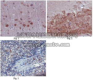 merck millipore,默克密理博,ABN200,Anti-C-X-C chemokine receptor type 5 (CXCR5) Antibody
