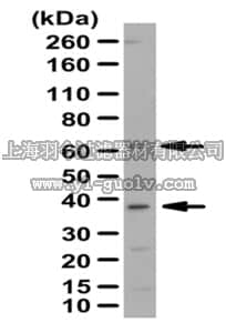 merck millipore,默克密理博,ABN259,Anti-PANK2 Antibody