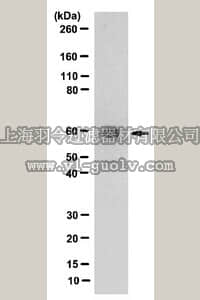merck millipore,默克密理博,ABN25,Anti-Thyroid Hormone Receptor β-1 Antibody