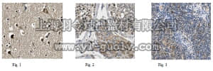 merck millipore,默克密理博,ABN263,Anti-ALK tyrosine kinase receptor Antibody