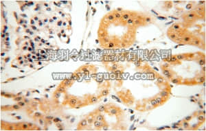 merck millipore,默克密理博,ABN264,Anti-HEXB Antibody
