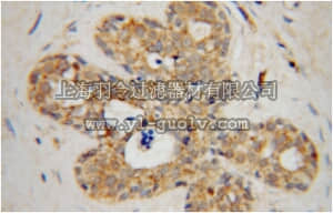 merck millipore,默克密理博,ABN301,Anti-HCCS Antibody