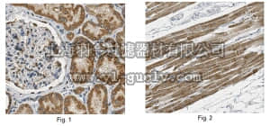 merck millipore,默克密理博,ABN302,Anti-Complex I-75kD Antibody