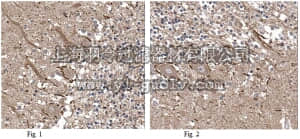 merck millipore,默克密理博,ABN304,Anti-Precerebellin Antibody
