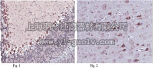 merck millipore,默克密理博,ABN307,Anti-LGI1 Antibody