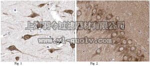 merck millipore,默克密理博,ABN328,Anti-Rcan2 Antibody merck millipore,默克密理博,ABN328,Anti-Rcan2 Antibody
