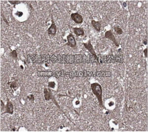 merck millipore,默克密理博,ABN335,Anti-LGI2 Antibody