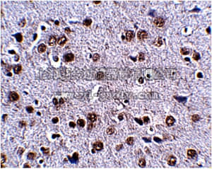 merck millipore,默克密理博,ABN337,Anti-LRFN4 Antibody