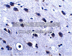 merck millipore,默克密理博,ABN339,Anti-LRFN2 Antibody