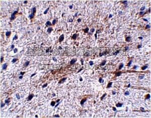 merck millipore,默克密理博,ABN340,Anti-LRFN5 Antibody