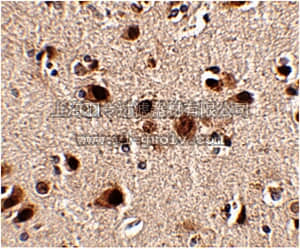 merck millipore,默克密理博,ABN344,Anti-Slitrk5 Antibody