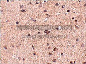 merck millipore,默克密理博,ABN345,Anti-Slitrk2 Antibody