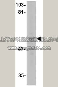 merck millipore,默克密理博,ABN346,Anti-LGI4 Antibody