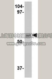 merck millipore,默克密理博,ABN347,Anti-LGI4 Antibody