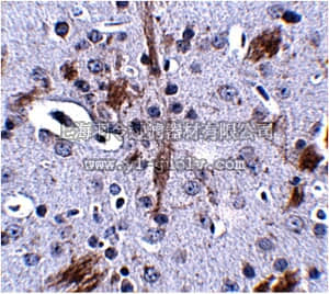 merck millipore,默克密理博,ABN348,Anti-TTBK1 Antibody