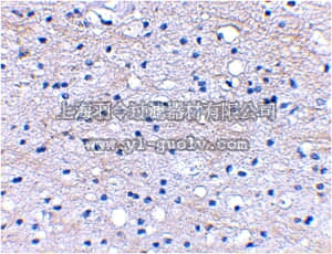 merck millipore,默克密理博,ABN349,Anti-BRAL1 Antibody