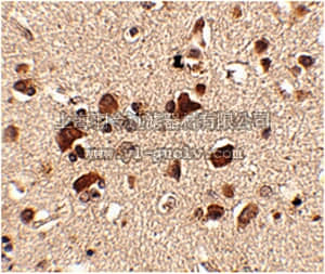 merck millipore,默克密理博,ABN350,Anti-Slitrk6 Antibody