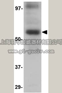 merck millipore,默克密理博,ABN351,Anti-LGI3 Antibody