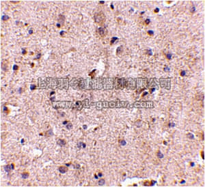 merck millipore,默克密理博,ABN353,Anti-SAPAP2 Antibody
