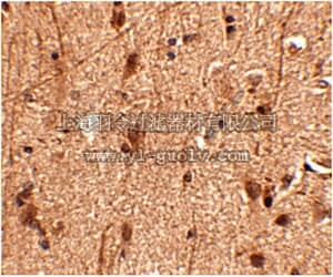merck millipore,默克密理博,ABN356,Anti-Slitrk3 Antibody