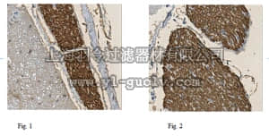 merck millipore,默克密理博,ABN363,Anti-Myelin Protein P0 Antibody
