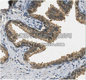 merck millipore,默克密理博,ABN366,Anti-Porphobilinogen Deaminase Antibody
