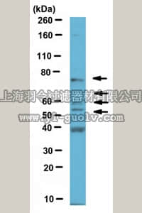 merck millipore,默克密理博,ABN368,Anti-Spastin Antibody