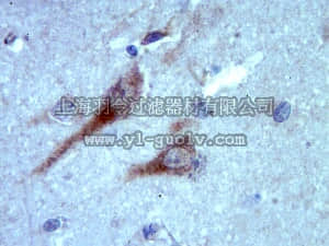 merck millipore,默克密理博,ABN38,Anti-RAB35 Antibody