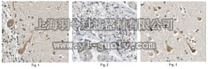 merck millipore,默克密理博,ABN404,Anti-MCPH1 Antibody