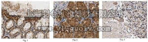 merck millipore,默克密理博,ABN408,Anti-MPRIP Antibody