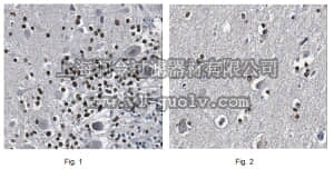 merck millipore,默克密理博,ABN430,Anti-LMO-1/Rhombotin-1 Antibody