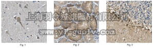 merck millipore,默克密理博,ABN435,Anti-mSphK1 Antibody