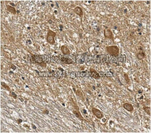merck millipore,默克密理博,ABN451,Anti-FE65 Antibody
