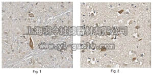 merck millipore,默克密理博,ABN458,Anti-Choline Transporter Antibody