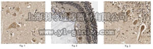 merck millipore,默克密理博,ABN45,Anti-Myelin Regulatory Factor (MRF) Antibody