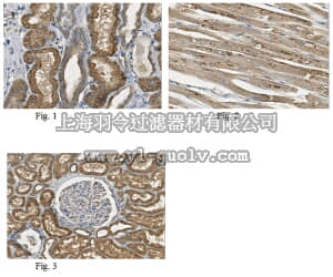 merck millipore,默克密理博,ABN468,Anti-ASAH1 Antibody