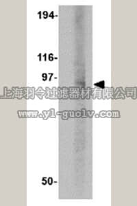 merck millipore,默克密理博,ABN469,Anti-DISC1 Antibody