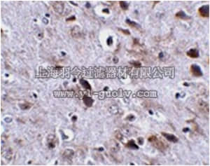 merck millipore,默克密理博,ABN471,Anti-TMEM18 Antibody
