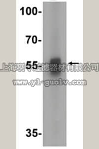 merck millipore,默克密理博,ABN472,Anti-TFEB Antibody