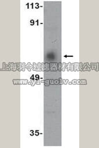 merck millipore,默克密理博,ABN476,Anti-ACVR1C Antibody